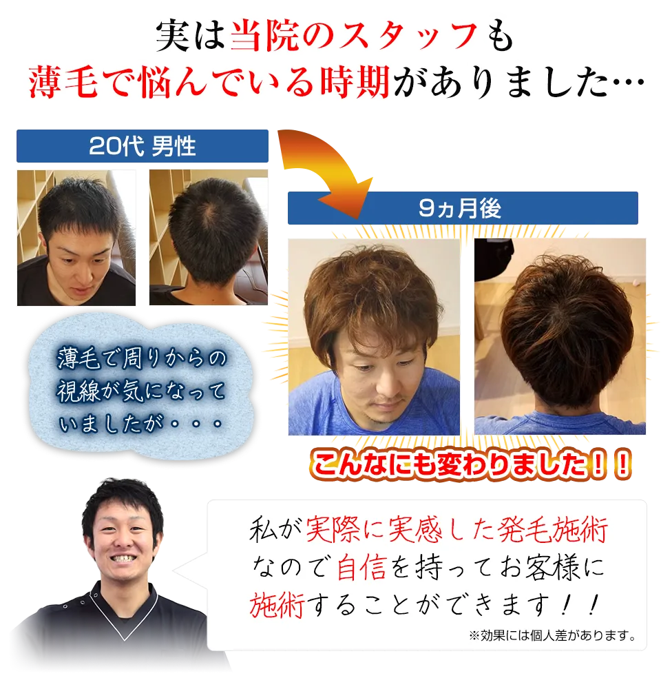 当院のスタッフも悩んでいた時期がありました