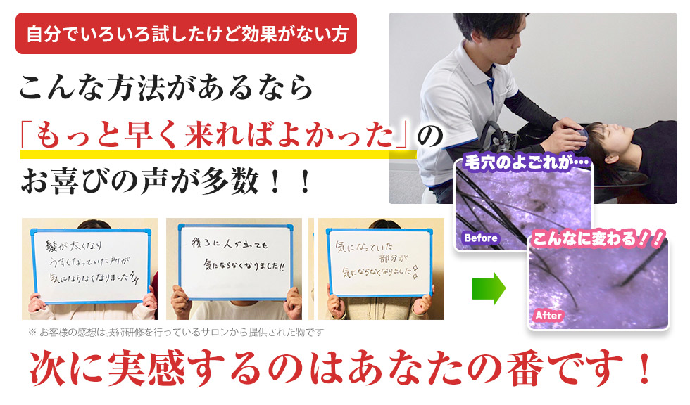 【発毛】実感するのはあなたの番です