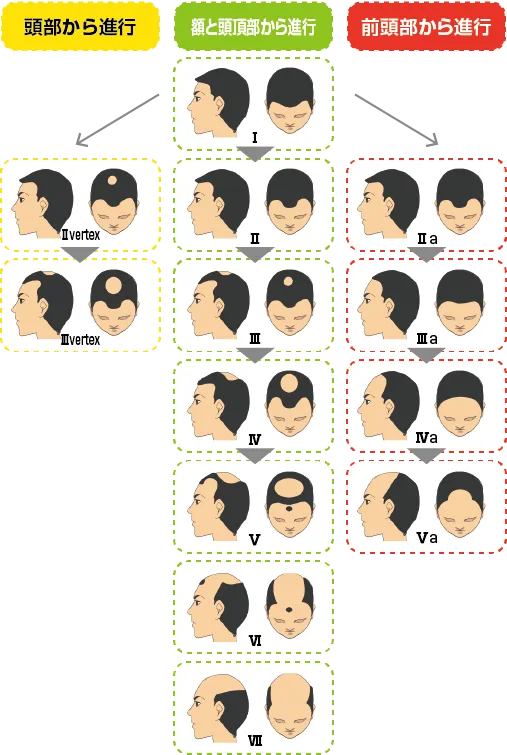 【発毛】頭皮レベル